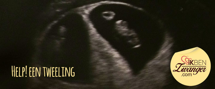 Tweelingzwangerschap: blog zwanger van een tweeling