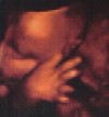 echo baby