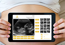 babywatcher