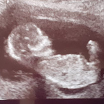 echo baby