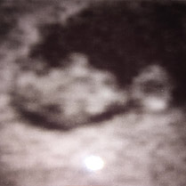echo baby 9 weken