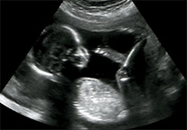 echo baby