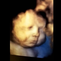 Huilen in de baarmoeder foetus