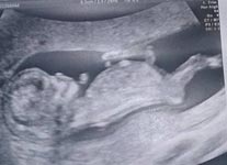 nub theorie echo foto