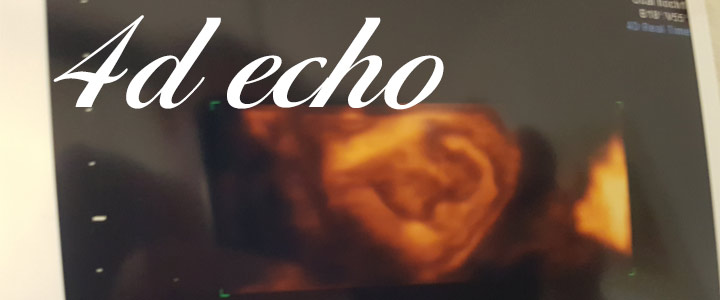 Inwendige 4d echo bij de frauenartz