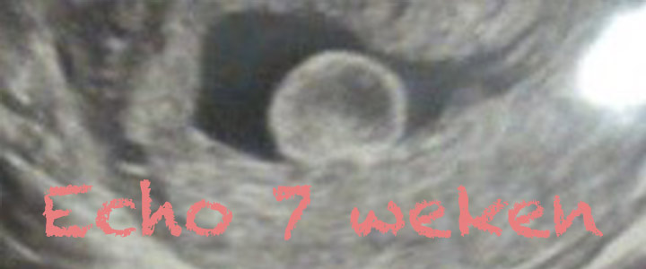 Smet op de feestvreugde van onze eerste 7 weken echo Smet op de feestvreugde van onze eerste 7 weken echo