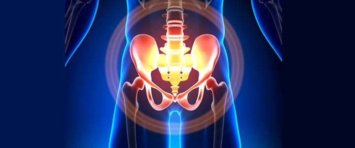 Cellulite - sinaasappelhuid Pijn in het schaambeen
