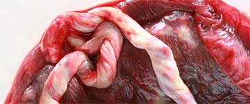 Zo gaat de keizersnede Placenta eten na je bevalling? Wel of niet gezond?