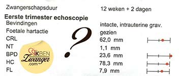 Vlog Dyna 15 weken zwanger Uitleg echoformulier zwangerschap