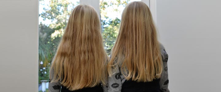 Tweeling extreem eenkennig Tweeling extreem eenkennig